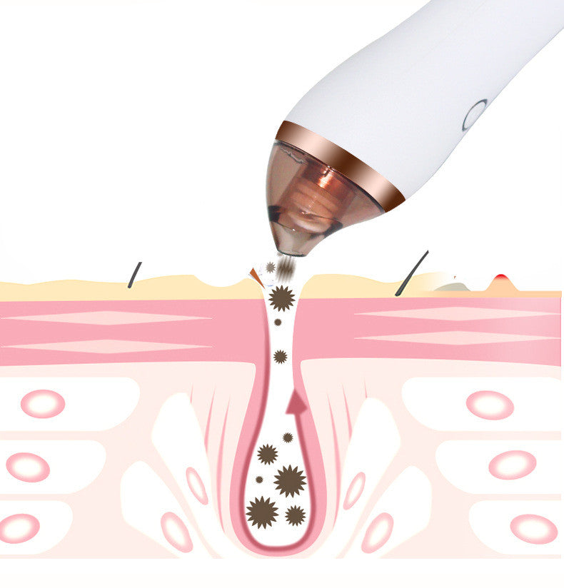 4-in-1 Facial Pore Vacuum & Body Cupping Therapy Device